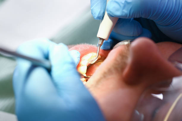 Best Weekend Emergency Dentist in Martsville, IN