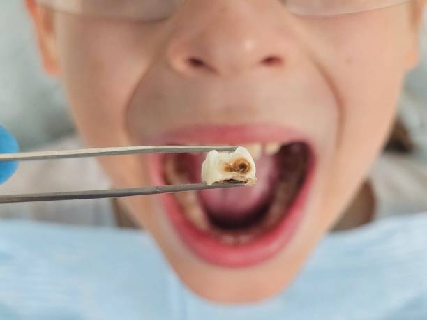 Best Pediatric Emergency Dentist in Martsville, IN